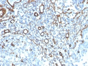 IHC staining of FFPE human tonsil with recombinant Collagen IV antibody. HIER: boil tissue sections in pH 9 10mM Tris with 1mM EDTA for 20 min and allow to cool before testing.