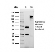 SDS-PAGE analysis of purified, BSA-free Alpha-2-Macroglobulin antibody as confirmation of integrity and purity.