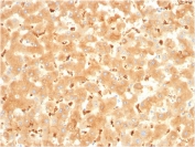 IHC staining of FFPE human liver with Alpha-2-Macroglobulin antibody. HIER: boil tissue sections in pH 9 10mM Tris with 1mM EDTA for 20 min and allow to cool before testing.
