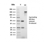 SDS-PAGE analysis of purified, BSA-free recombinant PD-ECGF antibody (clone rTYMP/3444) as confirmation of integrity and purity.