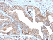 IHC staining of FFPE human placenta with recombinant PD-ECGF antibody (clone rTYMP/3444). HIER: boil tissue sections in pH 9 10mM Tris with 1mM EDTA for 20 min and allow to cool before testing.