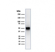 Western blot testing of human spleen lysate with recombinant PD-ECGF antibody (clone rTYMP/3444). Predicted molecular weight ~55 kDa.