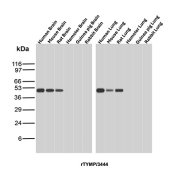 PD-ECGF Antibody Multi-Species Brain and Lung WB. Western blot analysis of brain and lung tissue lysates from multiple species using PD-ECGF antibody detecting thymidine phosphorylase (TYMP), clone rTYMP/3444. Brain panel includes human, mouse, rat, hamster, guinea pig, and rabbit samples, while lung panel includes human, mouse, rat, hamster, guinea pig, and rabbit samples. A band is detected at approximately 45-55 kDa across species, consistent with the predicted molecular weight of TYMP. The conserved detection pattern supports cross-species expression of this enzyme, which functions in thymidine metabolism and is also associated with angiogenic activity in tissues.