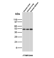 PD-ECGF Antibody Human Tissue WB. Western blot analysis of human liver, human lung, and human spleen lysates using PD-ECGF antibody detecting thymidine phosphorylase (TYMP), clone rTYMP/3444. A band is detected at approximately 45-55 kDa in all three tissues, consistent with the predicted molecular weight of TYMP. The observed pattern reflects expression of this enzyme across multiple tissue types, aligning with its roles in thymidine metabolism and angiogenesis-associated signaling.