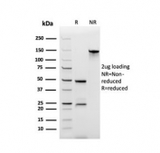 SDS-PAGE analysis of purified, BSA-free recombinant Secretory Component antibody (clone rSPM217) as confirmation of integrity and purity.