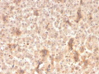 IHC staining of FFPE human liver with recombinant Secretory Component antibody (clone rSPM217). HIER: boil tissue sections in pH 9 10mM Tris with 1mM EDTA for 20 min and allow to cool before testing.~