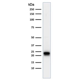 Western blot testing of human HeLa cell lysate with FTH antibody. Predicted molecular weight: ~21 kDa.