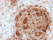 IHC staining of FFPE human pancreas with FTH antibody. HIER: boil tissue sections in pH 9 10mM Tris with 1mM EDTA for 20 min and allow to cool before testing.