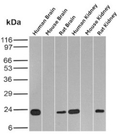 FTH Antibody Brain and Kidney WB. Western blot analysis of human, mouse, and rat brain and kidney tissue lysates using monoclonal clone FTH/2082 demonstrates distinct bands near 20-24 kDa corresponding to Ferritin heavy chain / FTH1 across multiple species and tissue types. The conserved expression profile supports the established role of FTH proteins in intracellular iron sequestration, oxidative stress protection, and maintenance of cellular iron homeostasis within metabolically active neural and renal tissues.