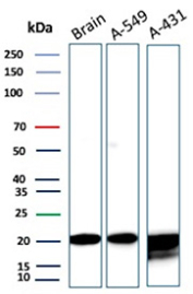 FTH Antibody Neural and Carcinoma WB. Western blot analysis of human brain, A-549, and A-431 lysates using monoclonal clone FTH/2082 demonstrates strong bands near 20-24 kDa consistent with Ferritin heavy chain / FTH1 expression. The observed signal across neural and epithelial carcinoma-derived samples supports the established role of FTH proteins in intracellular iron storage, oxidative stress response pathways, and metabolic adaptation in both normal and tumor-associated tissues.