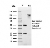 SDS-PAGE analysis of purified, BSA-free recombinant FTL antibody as confirmation of integrity and purity.