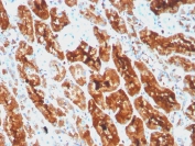 IHC staining of FFPE human kidney with recombinant FTL antibody. HIER: boil tissue sections in pH 9 10mM Tris with 1mM EDTA for 20 min and allow to cool before testing.
