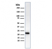 Western blot testing of human kidney lysate with recombinant FTL antibody. Predicted molecular weight: ~20 kDa.