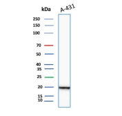 Recombinant FTL Antibody A-431 WB. Western blot analysis of A-431 cell lysate using recombinant FTL Antibody detects a strong band at approximately 20 kDa, consistent with ferritin light chain / FTL. The observed signal supports expression of this intracellular iron storage protein in epithelial-derived tumor cells and aligns with the established role of FTL in ferritin complex assembly, iron sequestration, oxidative stress regulation, and cellular iron homeostasis pathways.