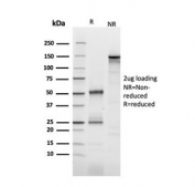 SDS-PAGE analysis of purified, BSA-free CD25 antibody (clone IL2RA/2393) as confirmation of integrity and purity.