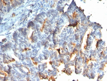 IHC staining of FFPE human small intestine with recombinant Mucin-1 antibody. HIER: boil tissue sections in pH 9 10mM Tris with 1mM EDTA for 20 min and allow to cool before testing.~