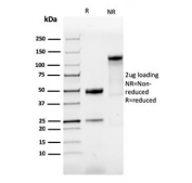 SDS-PAGE analysis of purified, BSA-free recombinant SOX9 antibody as confirmation of integrity and purity.
