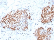 IHC staining of FFPE human pancreas with recombinant SOX9 antibody. HIER: boil tissue sections in pH 9 10mM Tris with 1mM EDTA for 20 min and allow to cool before testing.