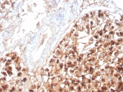 IHC staining of FFPE human pancreas with recombinant Eosinophil Peroxidase antibody (clone rEPO104). HIER: boil tissue sections in pH 9 10mM Tris with 1mM EDTA for 20 min and allow to cool before testing.