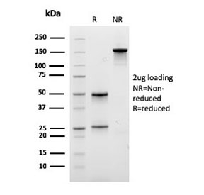 SDS-PAGE analysis of purified, BSA-free recombinant EPX antibody