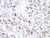 IHC staining of FFPE human pancreas with recombinant EPX antibody. HIER: boil tissue sections in pH 9 10mM Tris with 1mM EDTA for 20 min and allow to cool before testing.