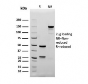 SDS-PAGE analysis of purified, BSA-free recombinant CD4 antibody (clone rC4/206) as confirmation of integrity and purity.