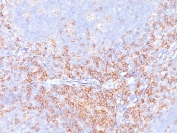 IHC staining of FFPE human tonsil with recombinant CD4 antibody. HIER: boil tissue sections in pH 9 10mM Tris with 1mM EDTA for 20 min and allow to cool before testing.