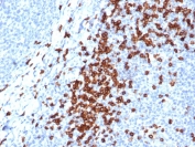 Analysis of HuProt(TM) microarray containing more than 19,000 full-length human proteins using recombinant CD8A antibody. These results demonstrate the foremost specificity of the CD8/4391R mAb. Z- and S- score: The Z-score represents the strength of a signal that an antibody (in combination with a fluorescently-tagged anti-IgG secondary Ab) produces when binding to a particular protein on the HuProt(TM) array. Z-scores are described in units of standard deviations (SD's) above the mean value of all signals generated on that array. If the targets on the HuProt(TM) are arranged in descending order of the Z-score, the S-score is the difference (also in units of SD's) between the Z-scores. The S-score therefore represents the relative target specificity of an Ab to its intended target.