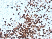 IHC staining of FFPE human tonsil with recombinant CD8A antibody. HIER: boil tissue sections in pH 9 10mM Tris with 1mM EDTA for 20 min and allow to cool before testing.