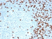 IHC staining of FFPE human tonsil tissue with recombinant CD8A antibody (clone CD8/4391R). HIER: boil tissue sections in pH 9 10mM Tris with 1mM EDTA for 20 min and allow to cool before testing.