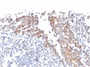 IHC staining of FFPE human tonsil with CD80 antibody (clone C80/3544). HIER: boil tissue sections in pH 9 10mM Tris with 1mM EDTA for 20 min and allow to cool before testing.