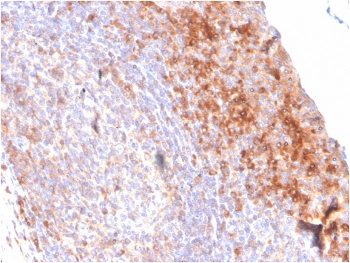 IHC staining of FFPE human tonsil with CD80 antibody (clone C80/3544). HIER: boil tissue sections in pH 9 10mM Tris with 1mM EDTA for 20 min and allow to cool before testing.