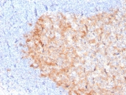 IHC staining of FFPE human tonsil with CD86 antibody (clone C86/3713). HIER: boil tissue sections in pH 9 10mM Tris with 1mM EDTA for 20 min and allow to cool before testing.