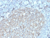 IHC staining of FFPE human tonsil with recombinant CD81 antibody (clone rC81/3442). HIER: boil tissue sections in pH 9 10mM Tris with 1mM EDTA for 20 min and allow to cool before testing.