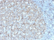 IHC staining of FFPE human tonsil with recombinant CD81 antibody (clone rC81/3442). HIER: boil tissue sections in pH 9 10mM Tris with 1mM EDTA for 20 min and allow to cool before testing.