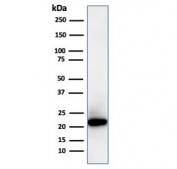 Western blot testing of human kidney lysate with recombinant Ferritin Light Chain antibody (clone FTL/3872R). Predicted molecular weight: ~20 kDa.
