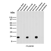 Recombinant Ferritin Light Chain Antibody Multi-Tissue WB. Western blot analysis of human brain, mouse brain, rat brain, human lung, mouse lung, rat lung, human kidney, mouse kidney, and rat kidney tissue lysates using Ferritin Light Chain Antibody detects strong bands at approximately 20-24 kDa in human brain, human lung, and human kidney samples, consistent with ferritin light chain / FTL. This recombinant rabbit monoclonal antibody supports detection of an intracellular iron storage protein involved in ferritin complex assembly, iron sequestration, oxidative stress response, and cellular iron homeostasis pathways.