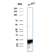 Recombinant Ferritin Light Chain Antibody A-431 WB. Western blot analysis of A-431 cell lysate using FTL Antibody detects a strong band at approximately 20 kDa, consistent with ferritin light chain / FTL. Additional weaker higher molecular weight signal may reflect ferritin complex-associated or partially processed ferritin species. This recombinant rabbit monoclonal antibody supports detection of an intracellular iron storage protein involved in ferritin complex assembly, iron sequestration, oxidative stress regulation, and cellular iron homeostasis pathways.