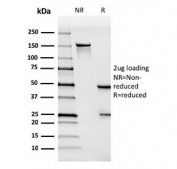 SDS-PAGE analysis of purified, BSA-free Mesothelin antibody (clone MSLN/3384) as confirmation of integrity and purity.