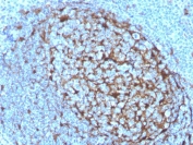 IHC staining of FFPE human tonsil with Cystatin A antibody (clone CSTA/3553). HIER: boil tissue sections in pH 9 10mM Tris with 1mM EDTA for 20 min and allow to cool before testing.