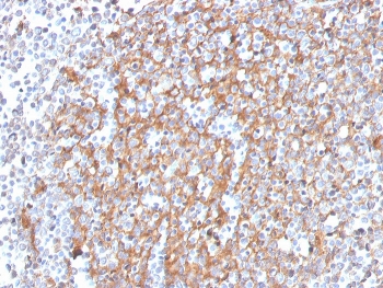 IHC staining of FFPE human prostate with Cystatin A antibody (clone CSTA/3553). HIER: boil tissue sections in pH 9 10mM Tris with 1mM EDTA for 20 min and allow to cool before testing.