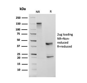 SDS-PAGE analysis of purified, BSA-free ACE antibody (clone ACE/3763) as confirmation of integrity and purity.