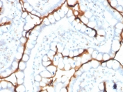 IHC staining of FFPE human small intestine with ACE antibody. HIER: boil tissue sections in pH 9 10mM Tris with 1mM EDTA for 20 min and allow to cool before testing.