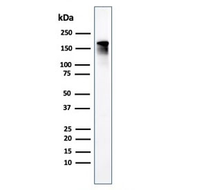 Western blot testing of human kidney lysate with ACE antibody. Expected molecular weight 140-170+ kDa depending on glycosylation level.
