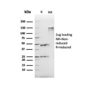 SDS-PAGE analysis of purified, BSA-free ACE antibody (clone ACE/3765) as confirmation of integrity and purity.