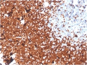 IHC staining of FFPE human thymus with TdT antibody. HIER: boil tissue sections in pH 9 10mM Tris with 1mM EDTA for 20 min and allow to cool before testing.