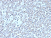 IHC staining of FFPE human liver with Factor VII antibody (clone F7/3511). HIER: boil tissue sections in pH 9 10mM Tris with 1mM EDTA for 20 min and allow to cool before testing.