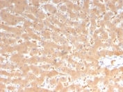 IHC staining of FFPE human liver with Factor VII antibody (clone F7/3513). HIER: boil tissue sections in pH 9 10mM Tris with 1mM EDTA for 20 min and allow to cool before testing.