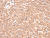 IHC staining of FFPE human liver with Factor VII antibody. HIER: boil tissue sections in pH 9 10mM Tris with 1mM EDTA for 20 min and allow to cool before testing.