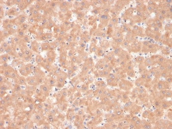 IHC staining of FFPE human liver with Factor VII antibody. HIER: boil tissue sections in pH 9 10mM Tris with 1mM EDTA for 20 min and allow to cool before testing.